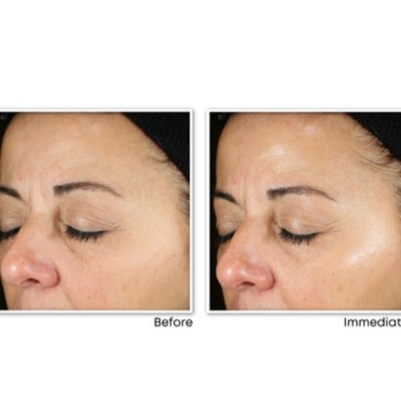 RoC Skincare Multi Correxion Revive + Glow Daily $40 - Picture 3 of 9